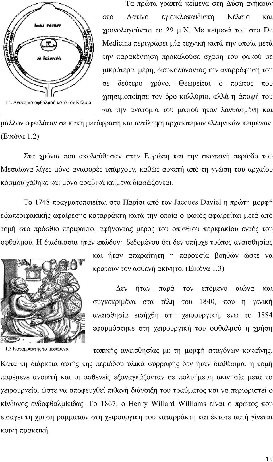 Με κείμενά του στο De Medicina περιγράφει μία τεχνική κατά την οποία μετά την παρακέντηση προκαλούσε σχάση του φακού σε μικρότερα μέρη, διευκολύνοντας την αναρρόφησή του σε δεύτερο χρόνο.