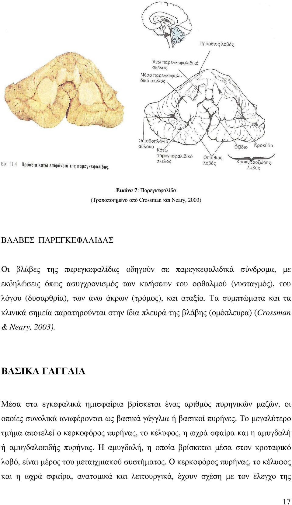 Τα συµπτώµατα και τα κλινικά σηµεία παρατηρούνται στην ίδια πλευρά της βλάβης (οµόπλευρα) (Crossman & Neary, 2003).