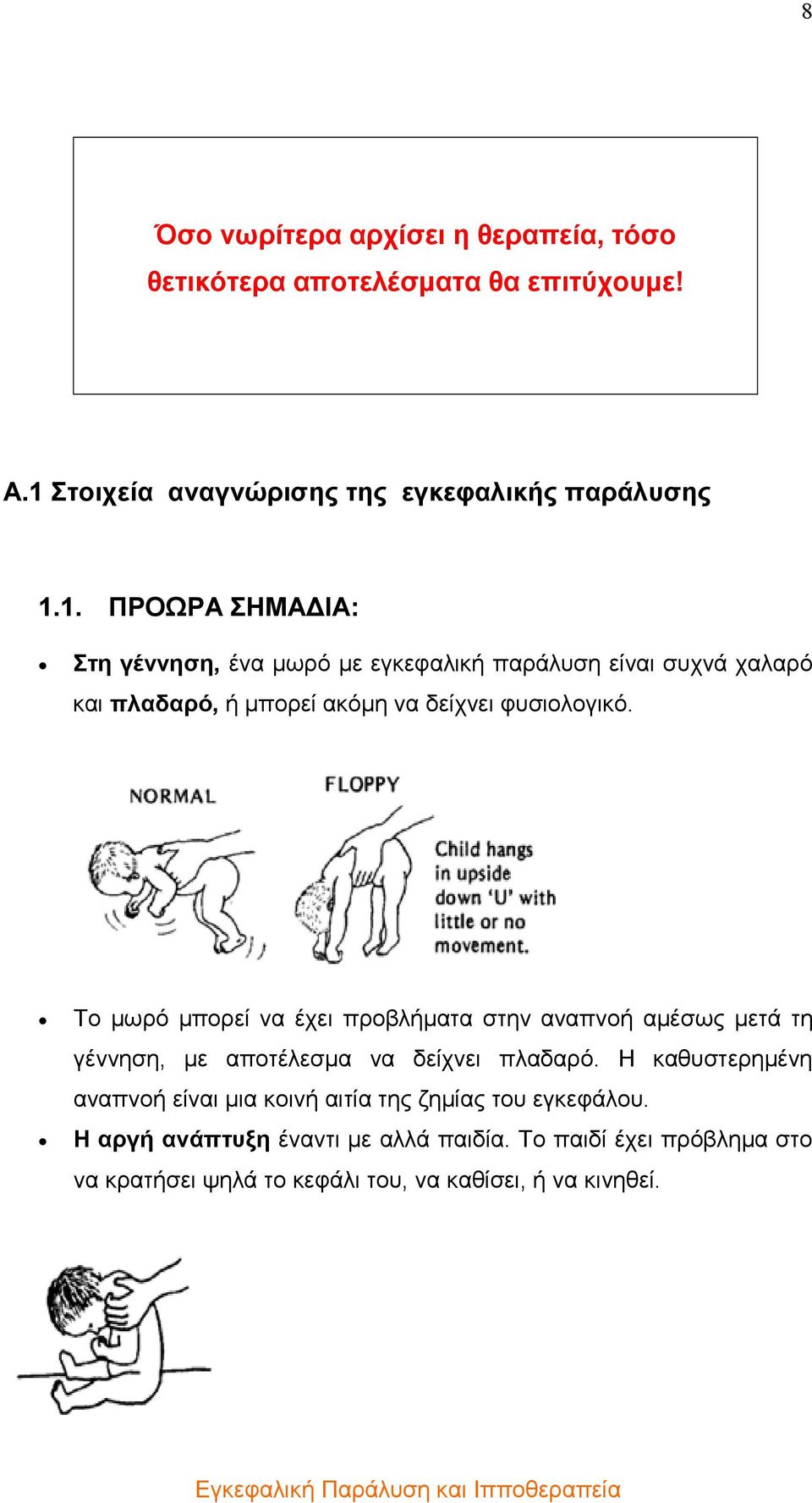 1. ΠΡΟΩΡΑ ΣΗΜΑ ΙΑ: Στη γέννηση, ένα µωρό µε εγκεφαλική παράλυση είναι συχνά χαλαρό και πλαδαρό, ή µπορεί ακόµη να δείχνει φυσιολογικό.