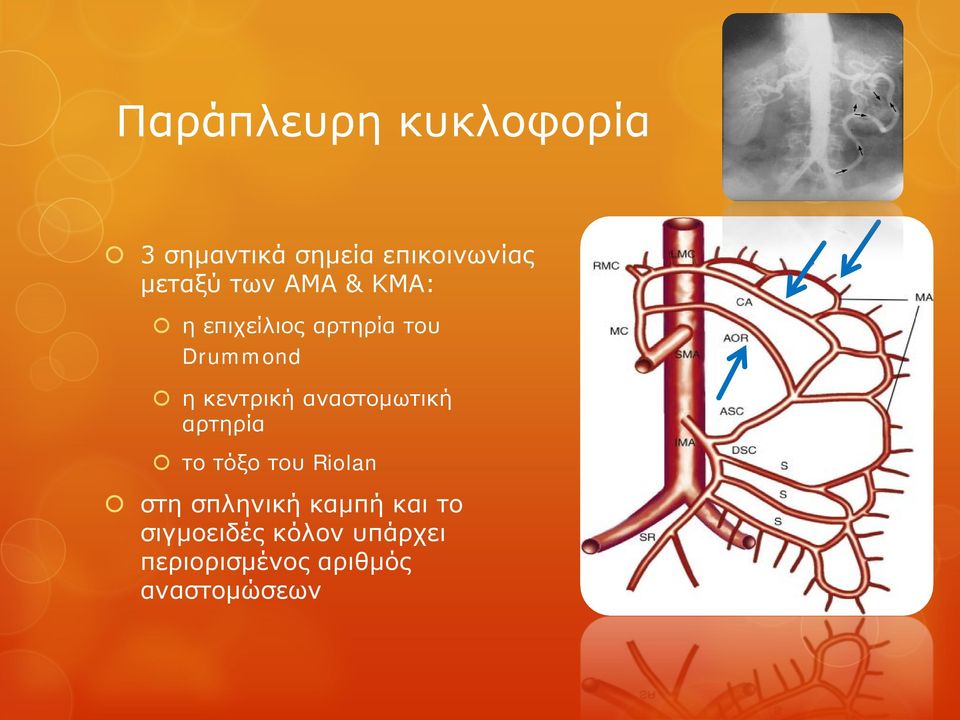 αναστομωτική αρτηρία το τόξο του Riolan στη σπληνική καμπή