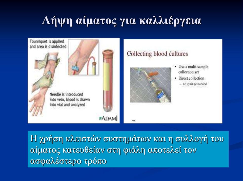 συλλογή του αίματος κατευθείαν