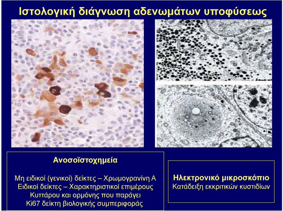 Χαρακτηριστικοί επιμέρους Κυττάρου και ορμόνης που παράγει Ki67