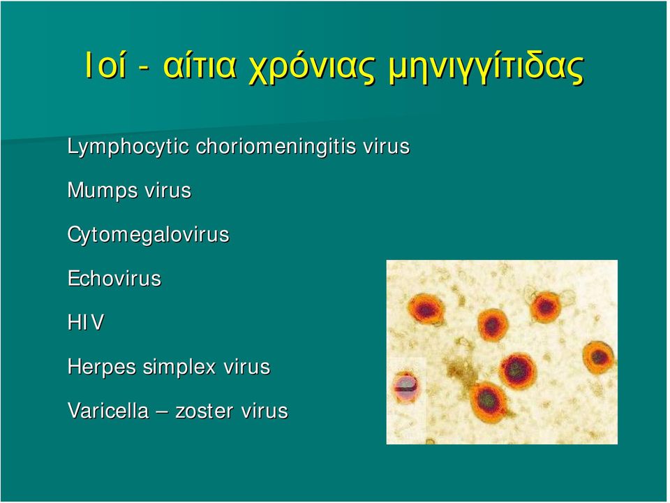 Mumps virus Cytomegalovirus Echovirus