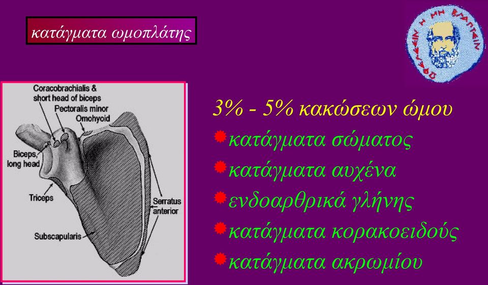 κατάγματα αυχένα ενδοαρθρικά