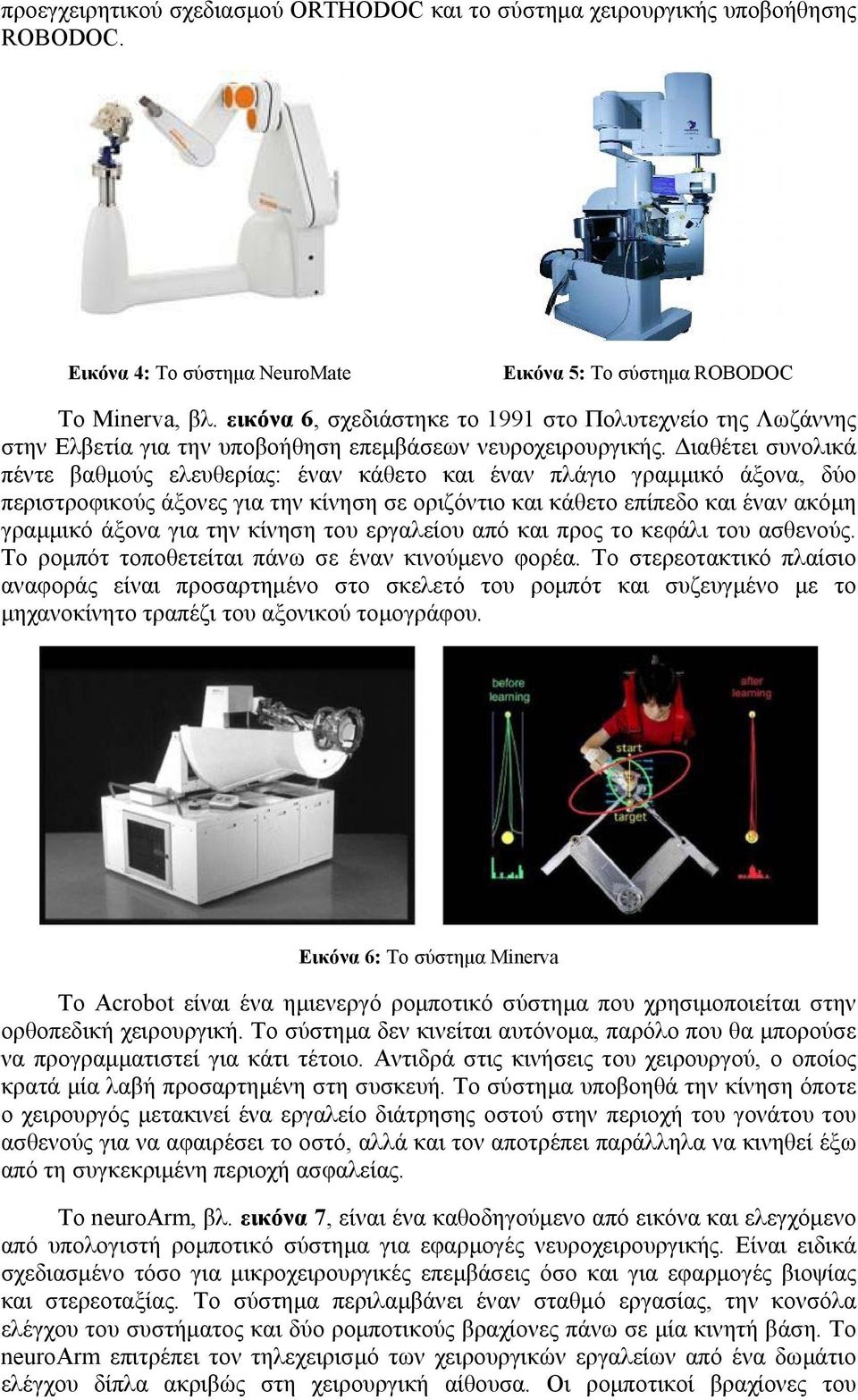 Διαθέτει συνολικά πέντε βαθμούς ελευθερίας: έναν κάθετο και έναν πλάγιο γραμμικό άξονα, δύο περιστροφικούς άξονες για την κίνηση σε οριζόντιο και κάθετο επίπεδο και έναν ακόμη γραμμικό άξονα για την