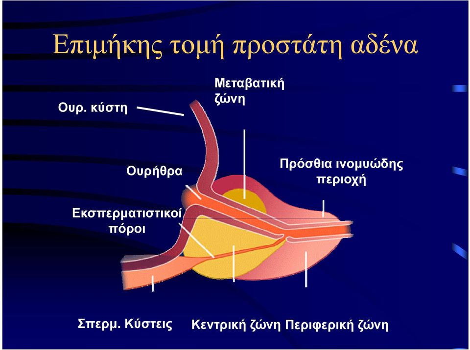 ινομυώδης περιοχή Εκσπερματιστικοί