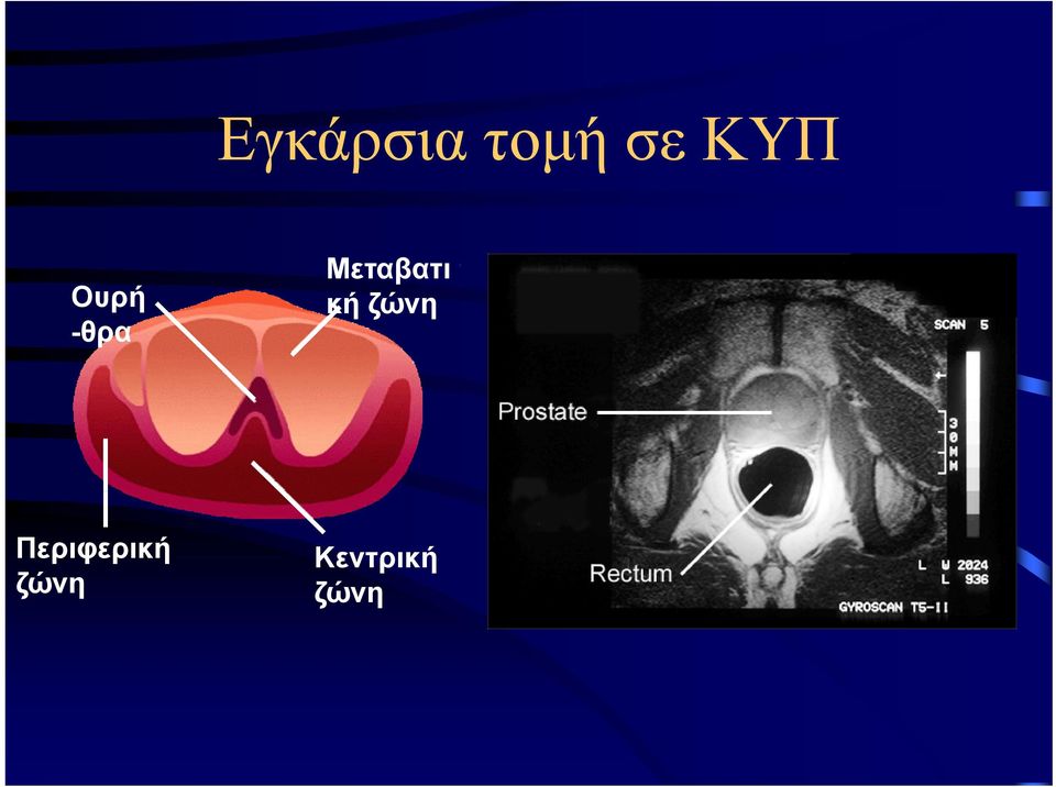 Μεταβατι κή ζώνη