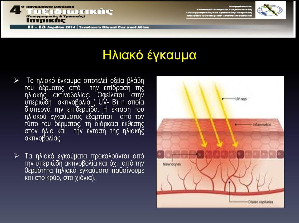 Η έκταση του ηλιακού εγκαύματος εξαρτάται από τον τύπο του δέρματος, τη διάρκεια έκθεσης στον ήλιο και την ένταση της