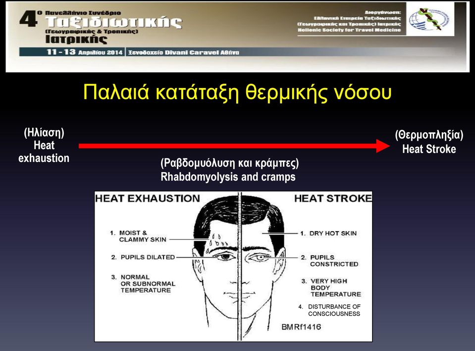 κράμπες) Rhabdomyolysis and cramps