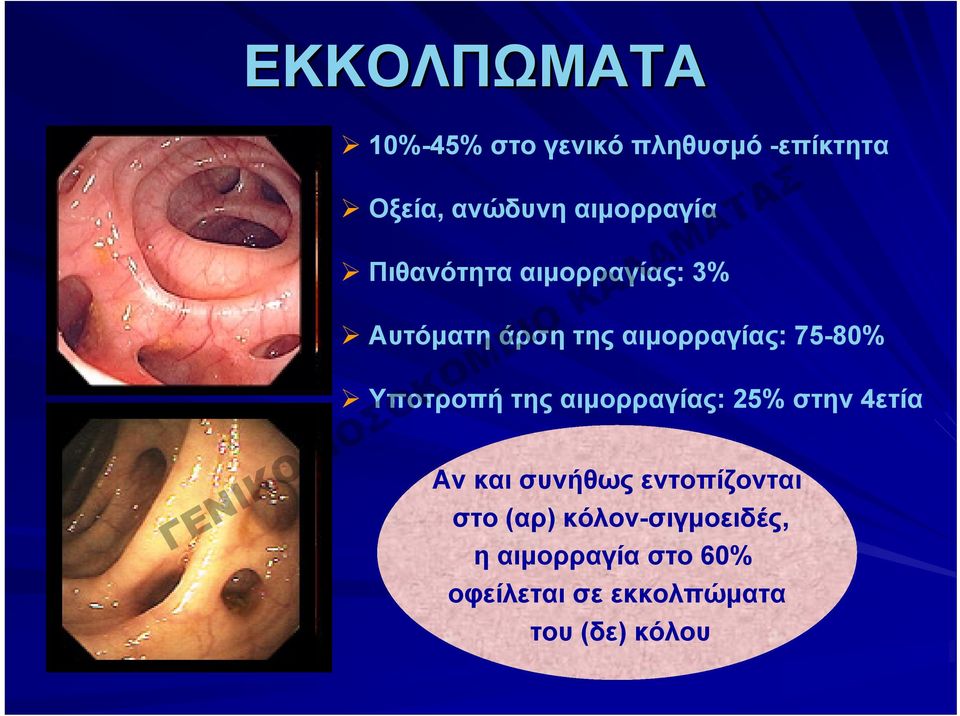 της αιμορραγίας: 25% στην 4ετία Αν και συνήθως εντοπίζονται στο (αρ)