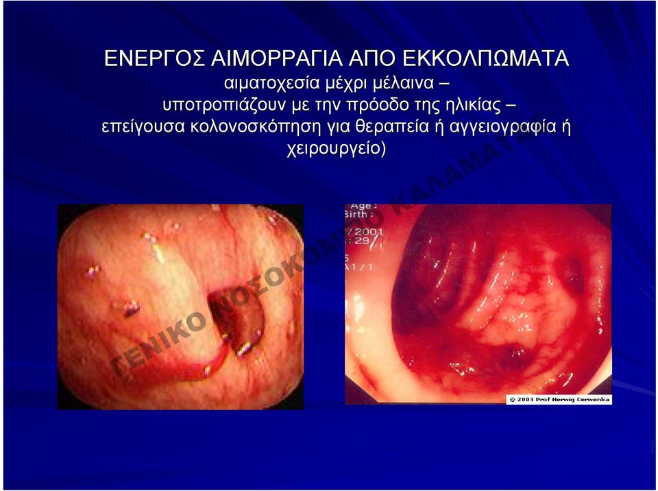 με την πρόοδο της ηλικίας επείγουσα