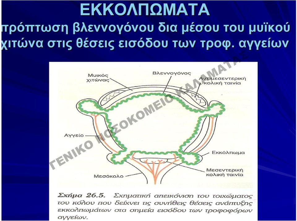 του μυϊκού ιτώνα στις