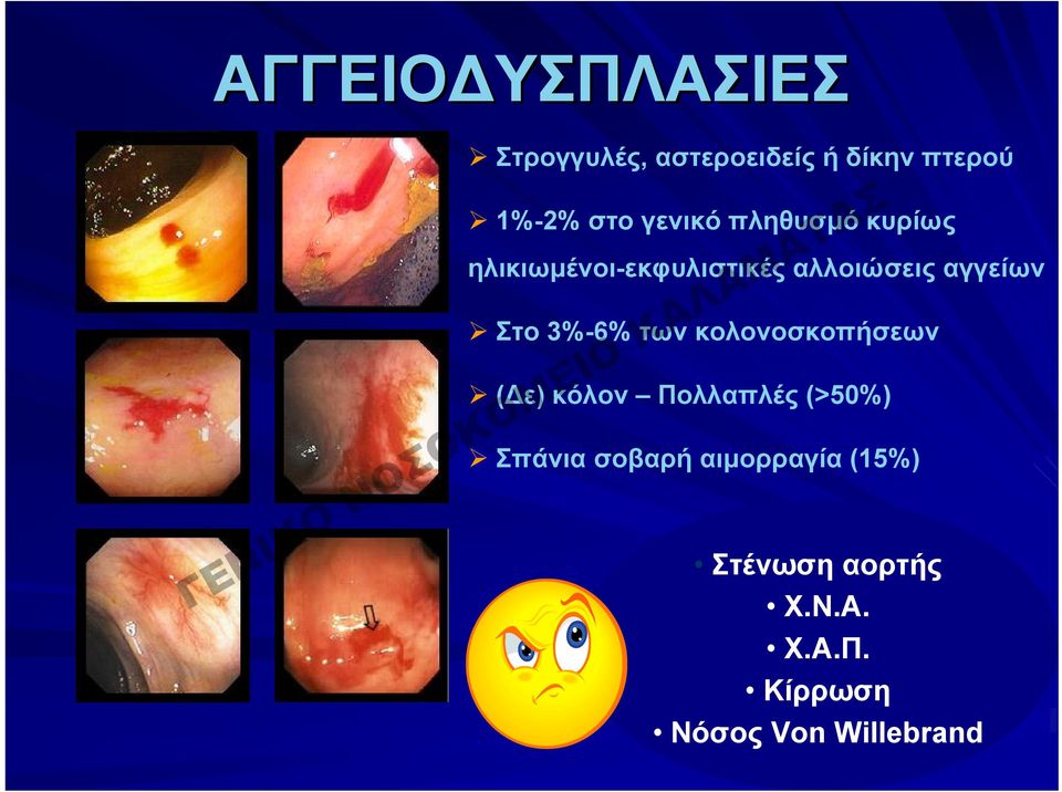 Στο 3%-6% των κολονοσκοπήσεων (Δε) κόλον Πολλαπλές (>50%) Σπάνια