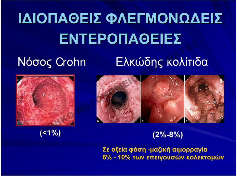 (2%-8%) Σε οξεία φάση -μαζική