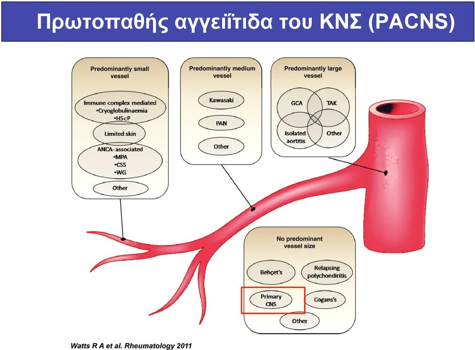 ΚΝΣ (PACNS) Watts