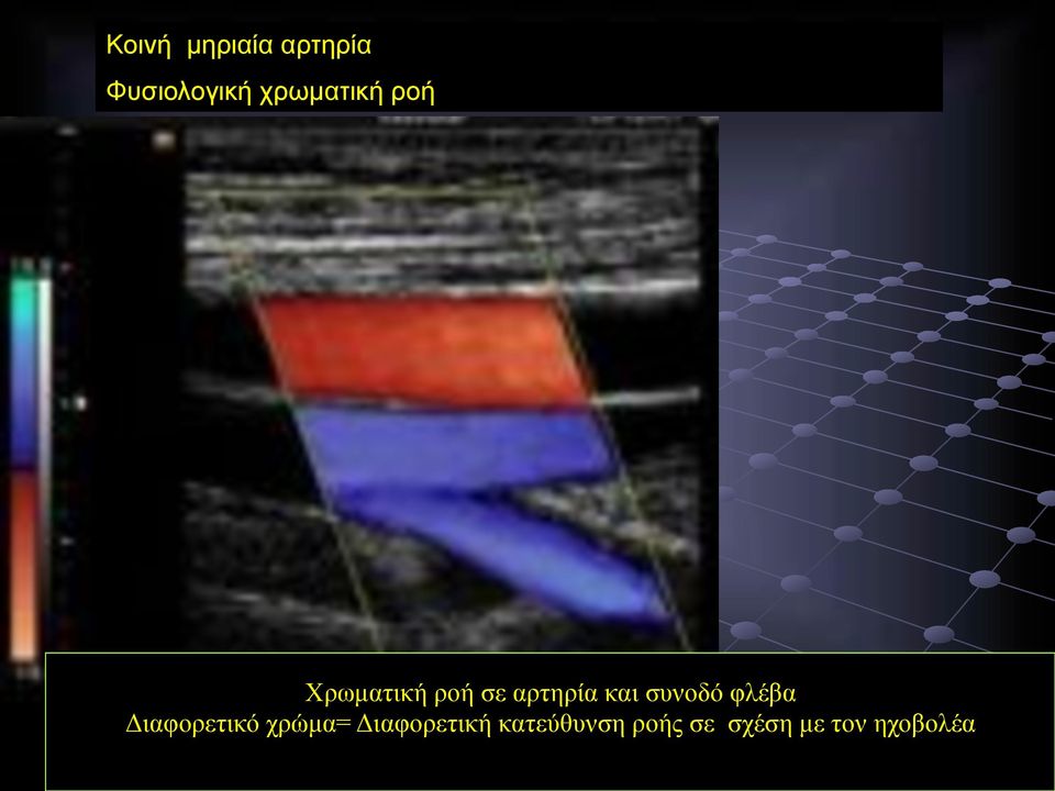 και συνοδό φλέβα Διαφορετικό χρώµα=