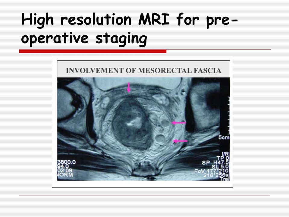 MRI for