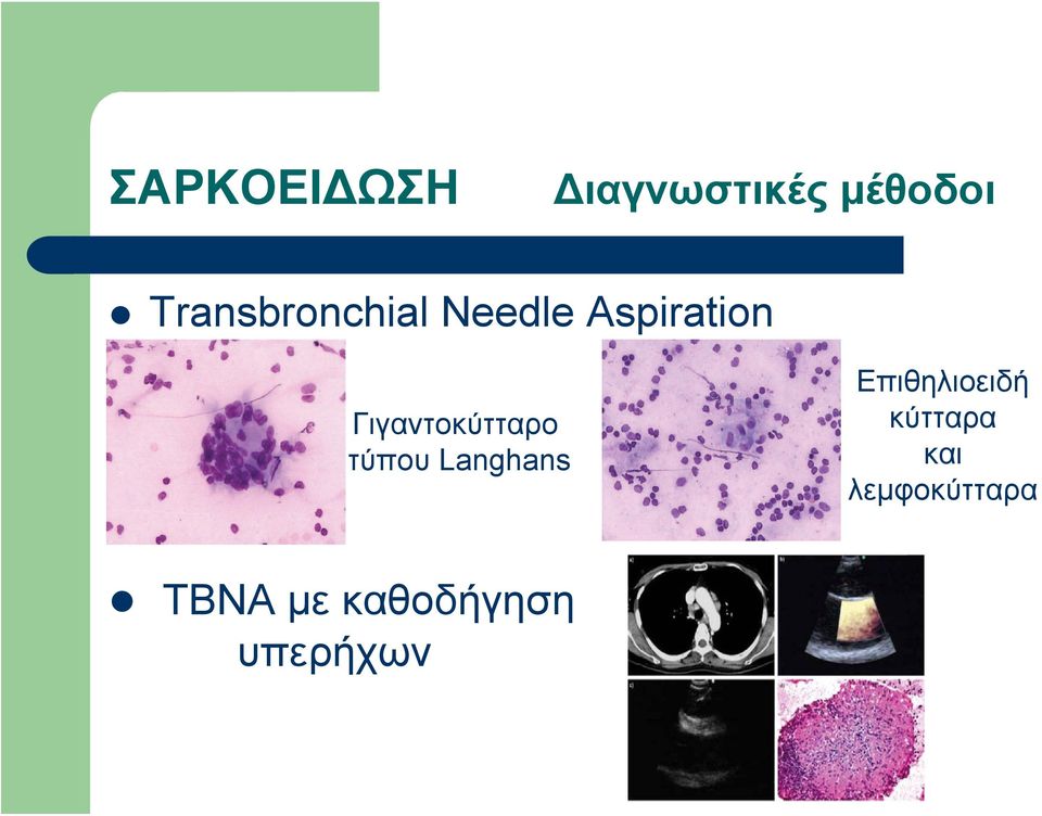 τύπου Langhans Επιθηλιοειδή κύτταρα