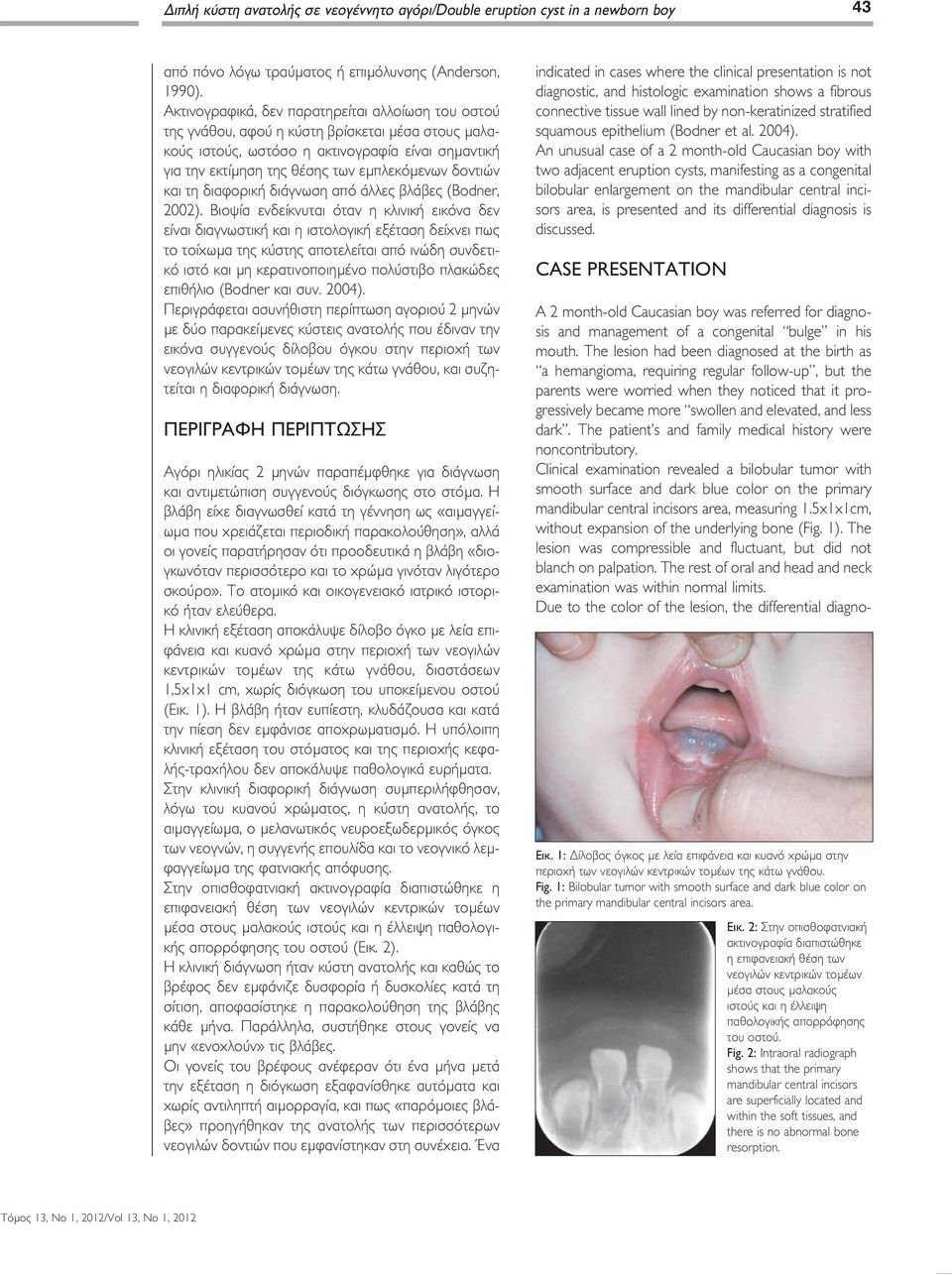 δοντιών και τη διαφορική διάγνωση από άλλες βλάβες (Bodner, 2002).
