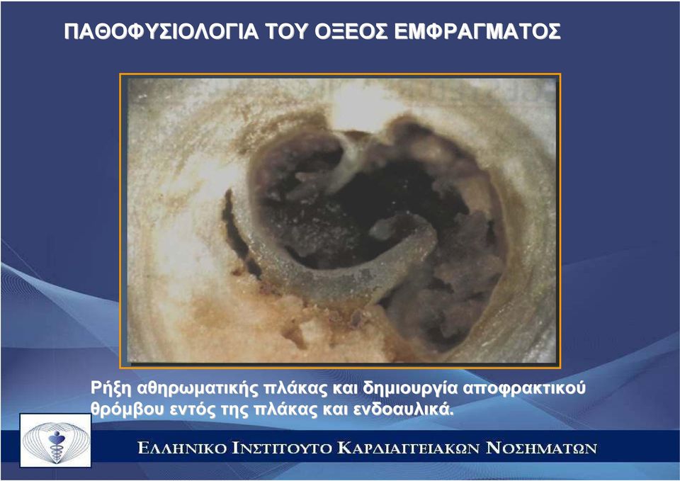 πλάκας και δηµιουργία