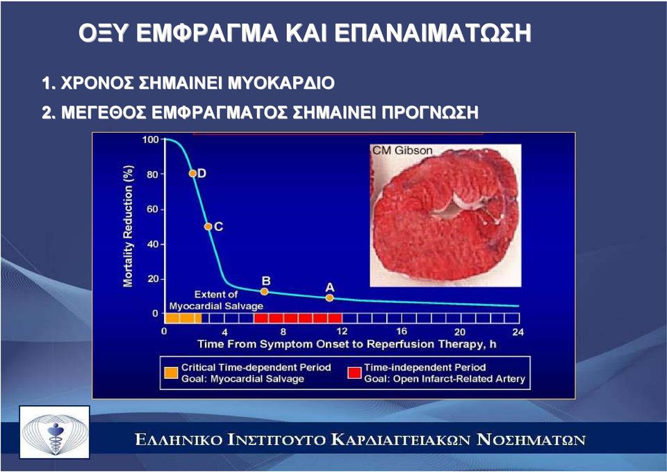 ΧΡΟΝΟΣ ΣΗΜΑΙΝΕΙ ΜΥΟΚΑΡ