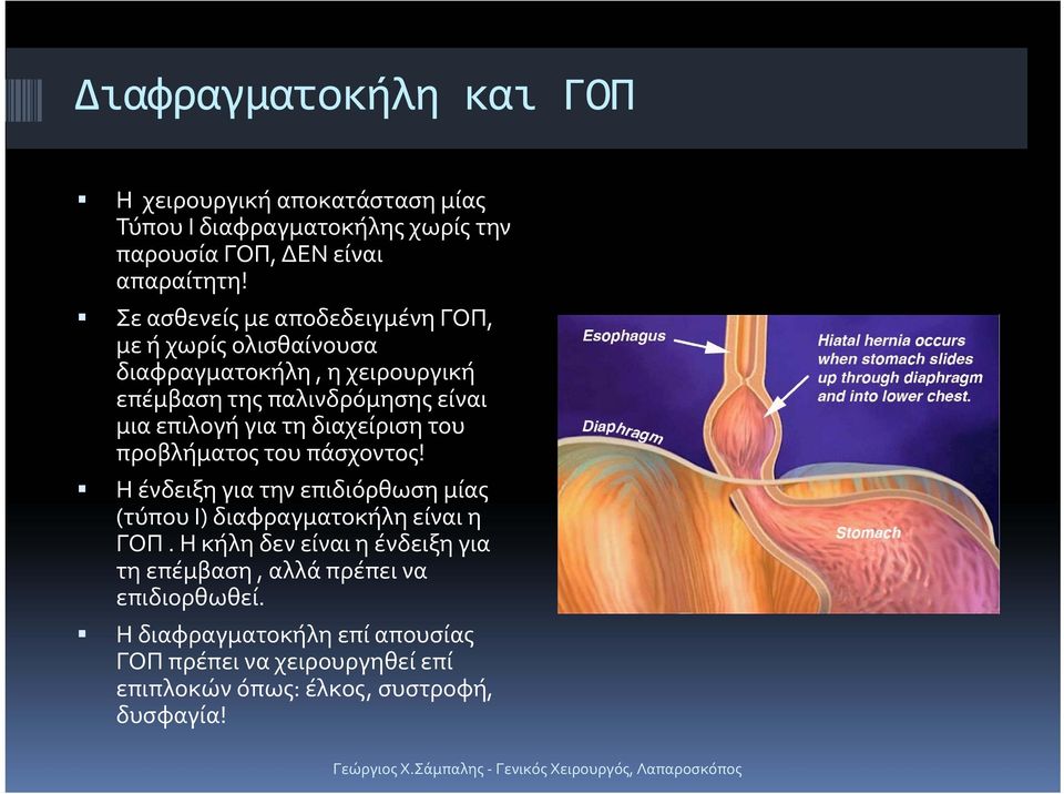 διαχείριση του προβλήματος του πάσχοντος! Η ένδειξη για την επιδιόρθωση μίας (τύπου Ι) διαφραγματοκήλη είναι η ΓΟΠ.