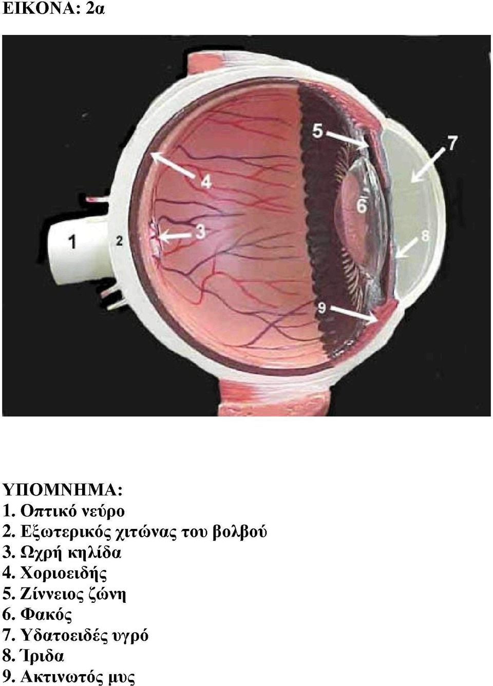 Ωχρή κηλίδα 4. Χοριοειδής 5.