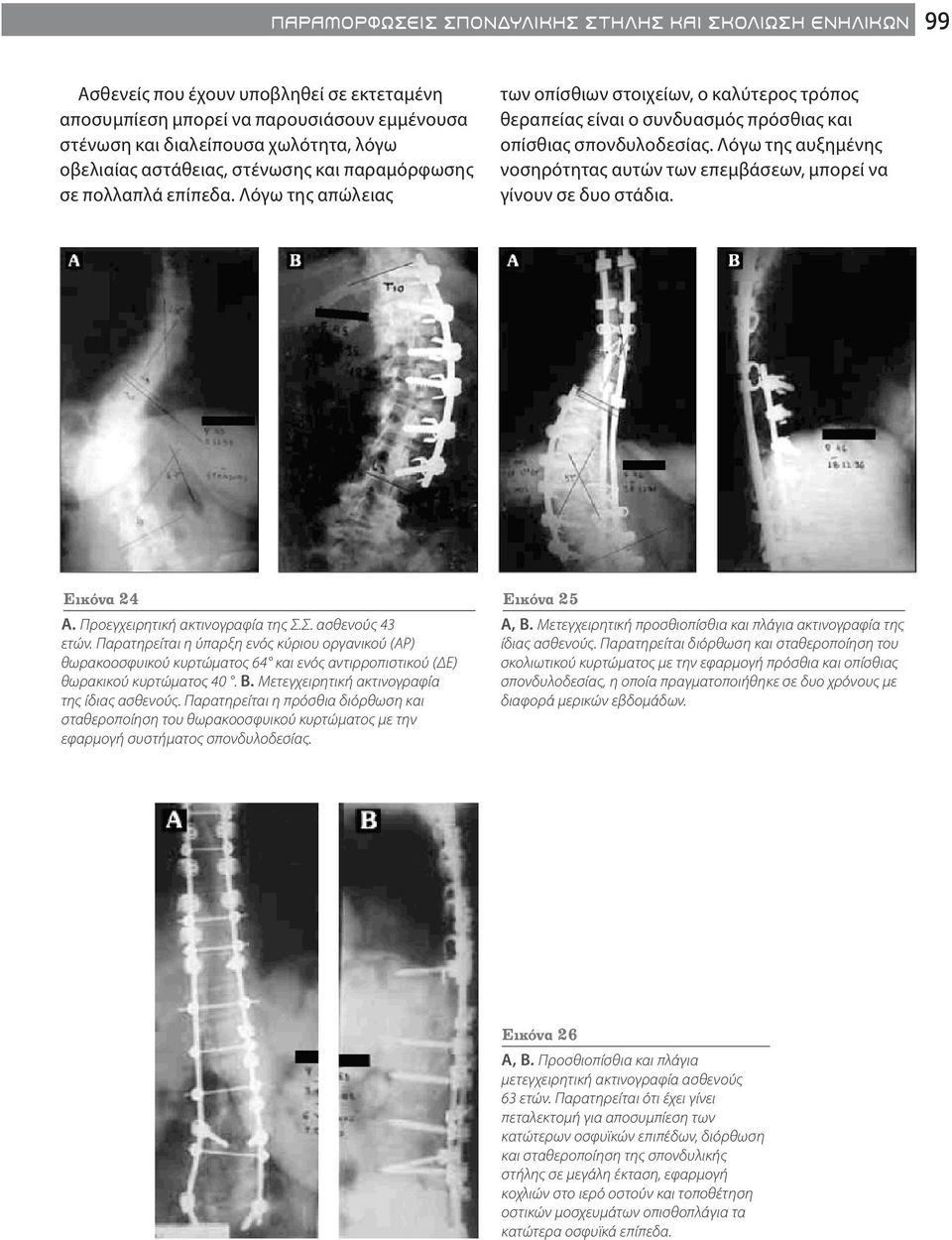 Λόγω της αυξημένης νοσηρότητας αυτών των επεμβάσεων, μπορεί να γίνουν σε δυο στάδια. Εικόνα 24 A. Προεγχειρητική ακτινογραφία της Σ.Σ. ασθενούς 43 ετών.