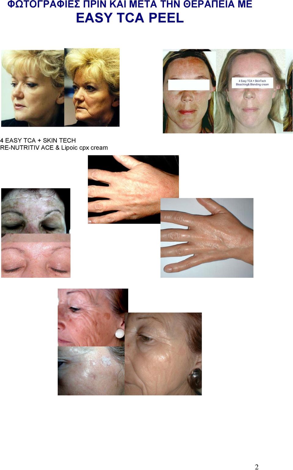 RE-NUTRITIV ACE & Lipoic cpx cream 2 κύκλοι