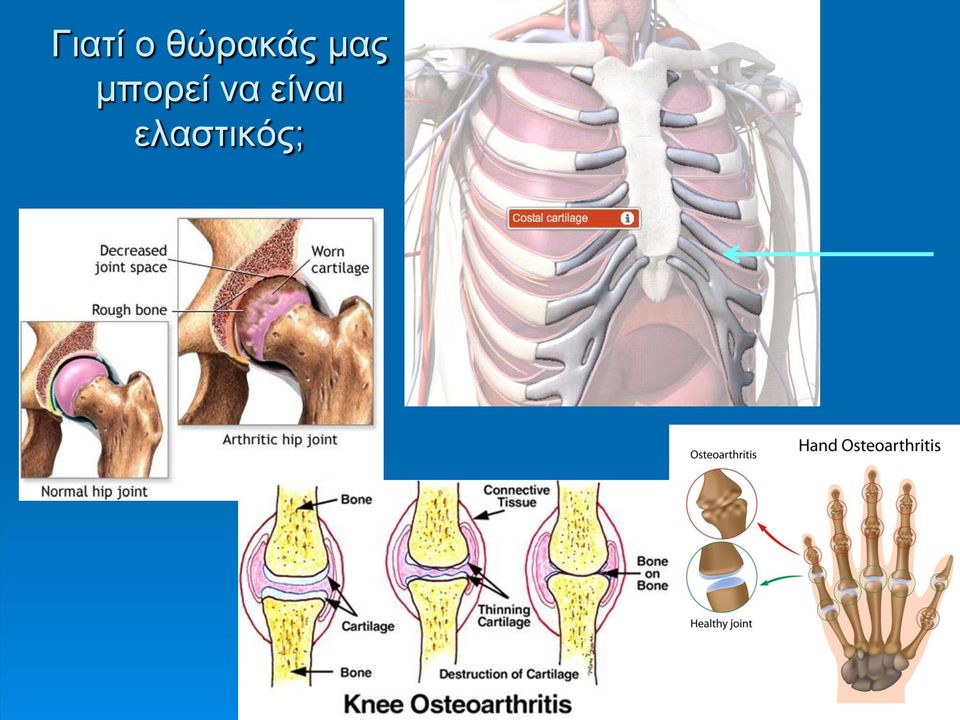 μπορεί να