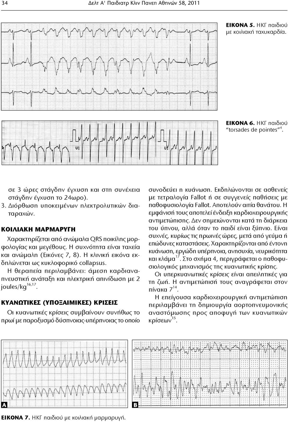 ΚΟΙΛΙΑΚΗ ΜΑΡΜΑΡΥΓΗ Χαρακτηρίζεται από ανώμαλα QRS ποικίλης μορφολογίας και μεγέθους. Η συχνότητα είναι ταχεία και ανώμαλη (Eικόνες 7, 8). Η κλινική εικόνα εκδηλώνεται ως κυκλοφορικό collapsus.