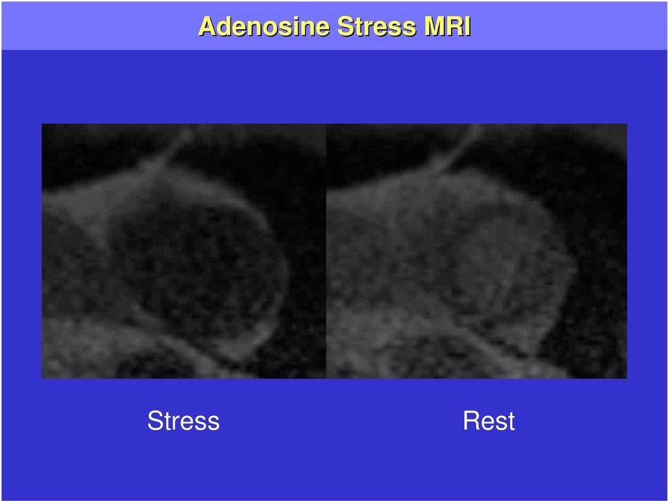 MRI  Rest