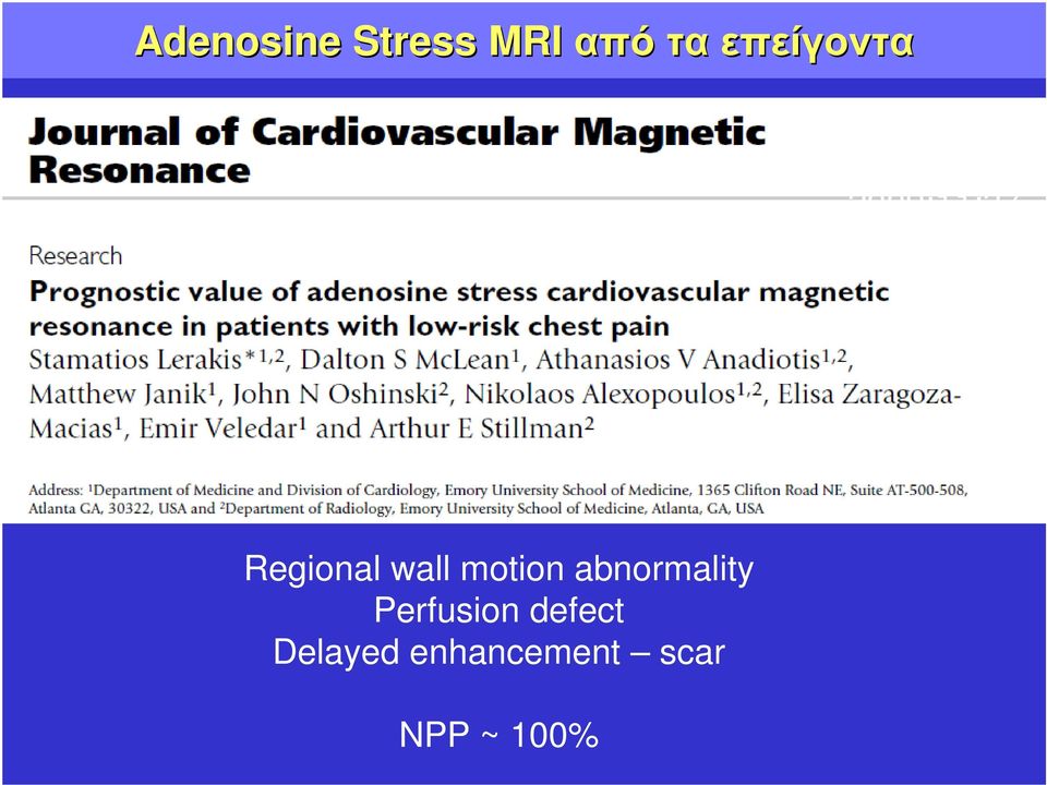wall motion abnormality Perfusion