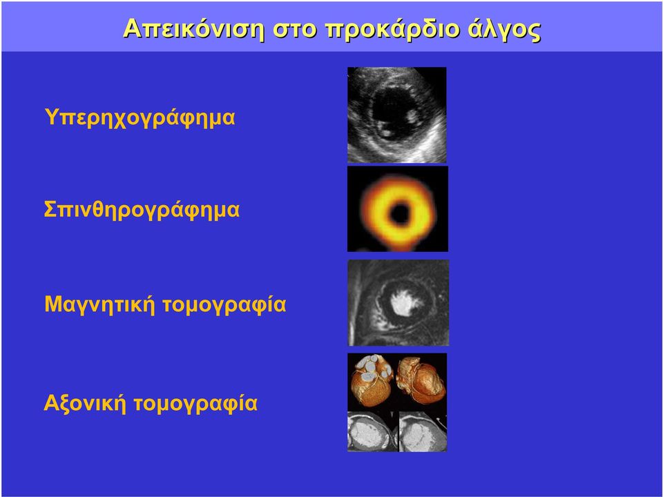 Σπινθηρογράφηµα Μαγνητική