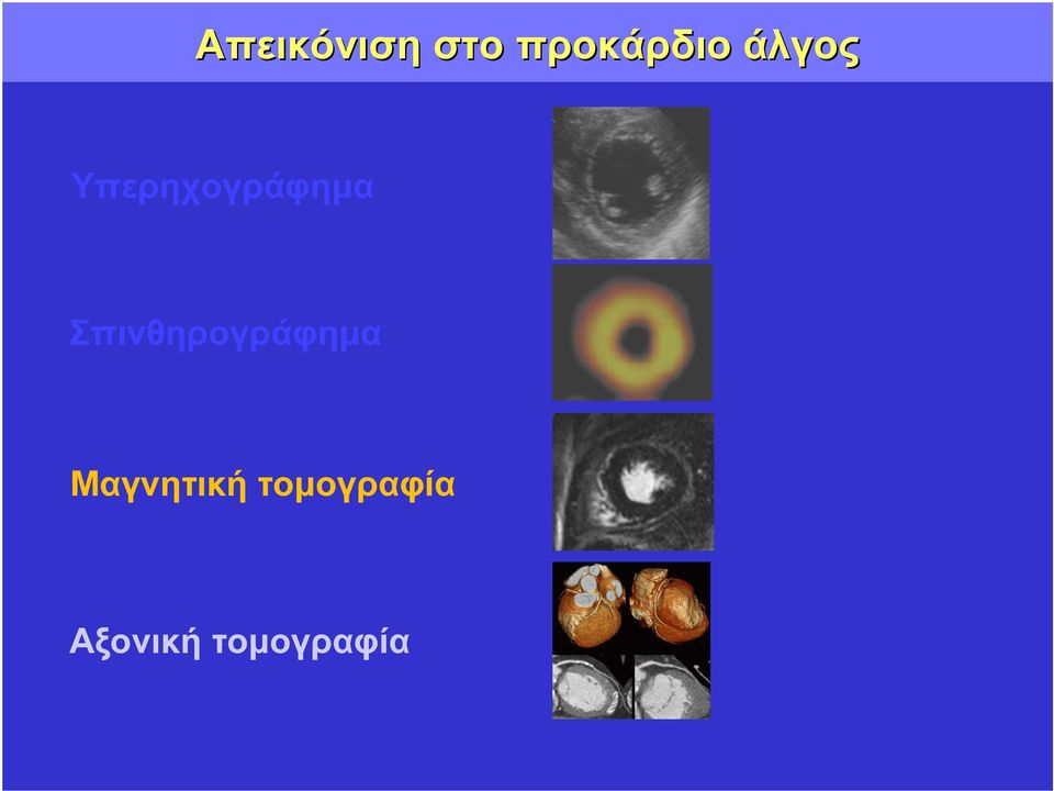 Σπινθηρογράφηµα Μαγνητική