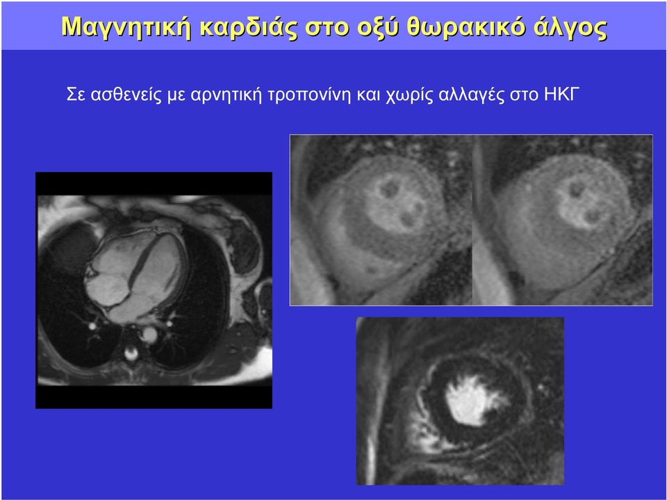 ασθενείς µε αρνητική