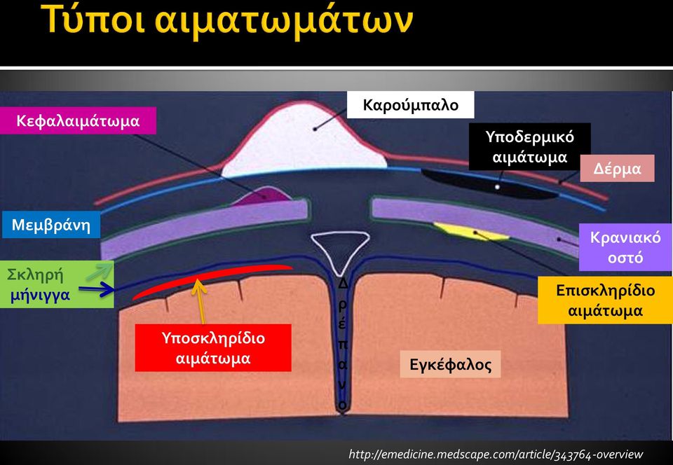 π α ν ο Εγκέφαλος Κρανιακό οστό Επισκληρίδιο