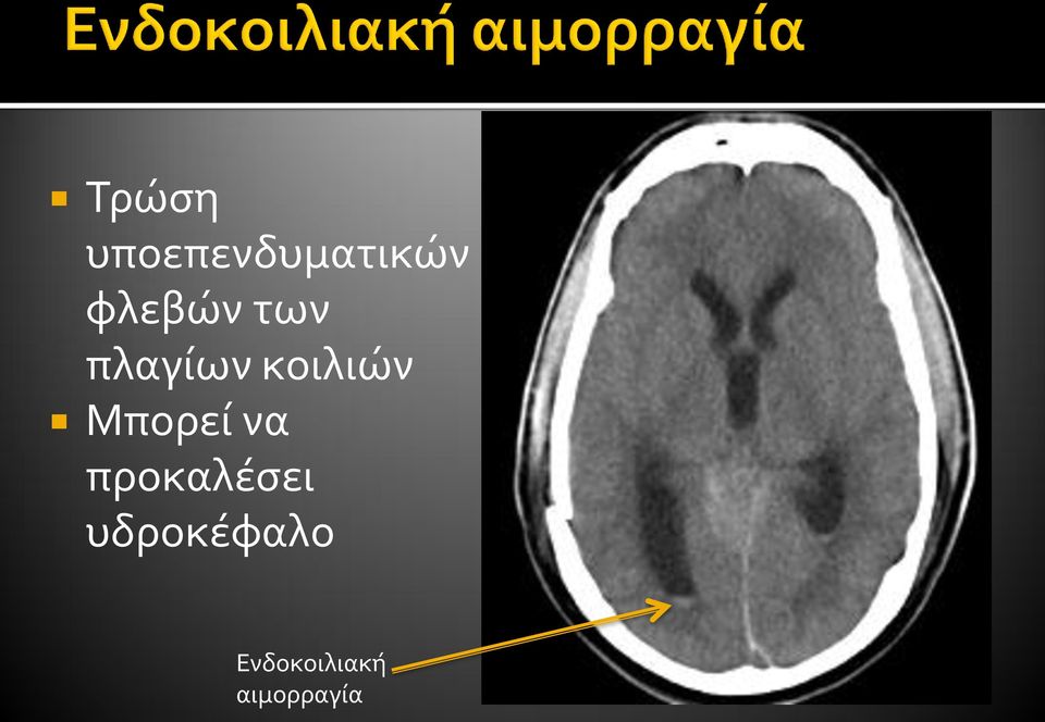 Μπορεί να προκαλέσει