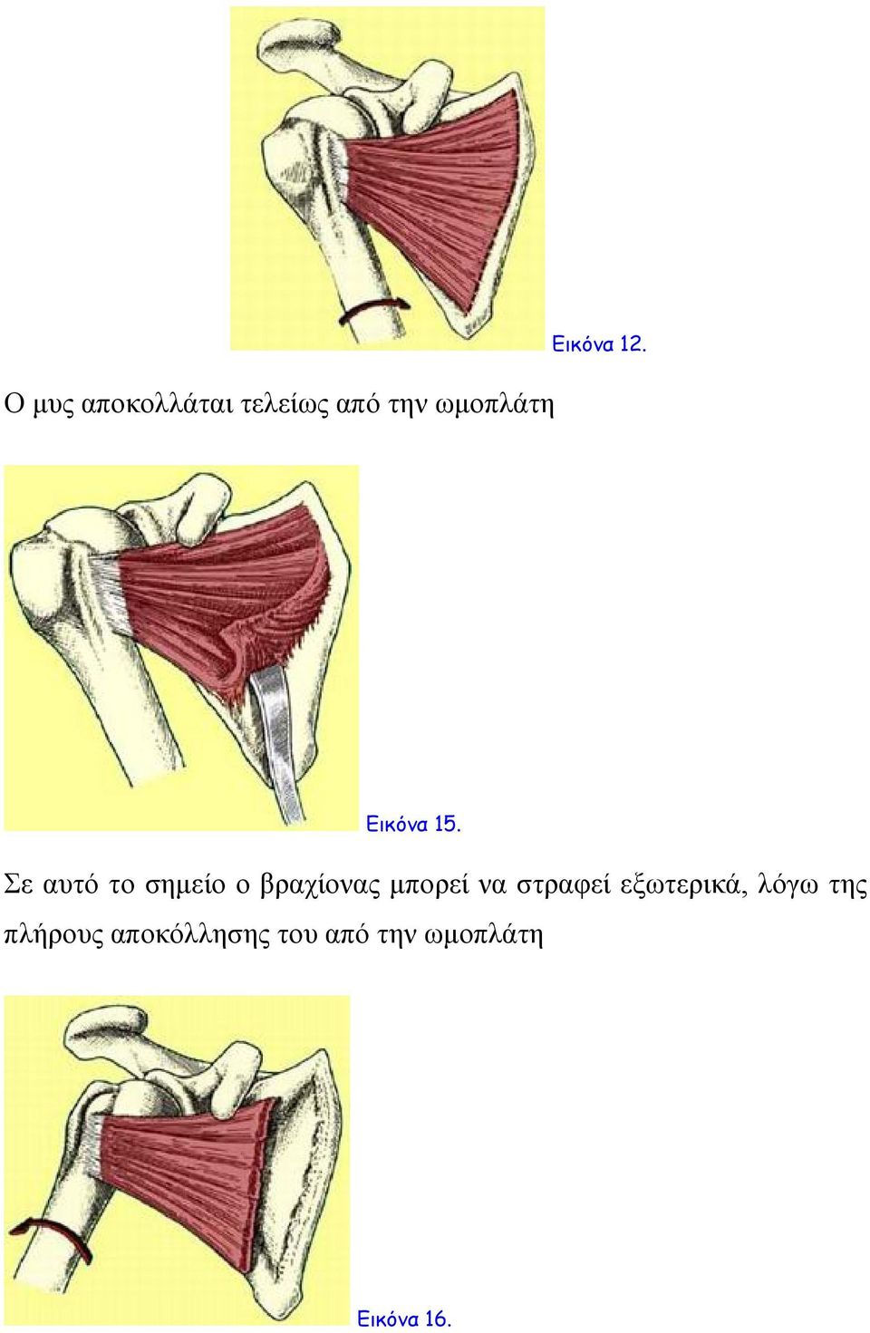 Σε αυτό το σημείο ο βραχίονας μπορεί να