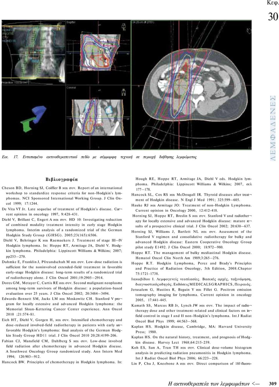 Late sequelae of treatment of Hodgkin's disease. Cur rent opinion in oncology 1997, 9:428-431. Diehl V, Brillant C, Engert A και συν.