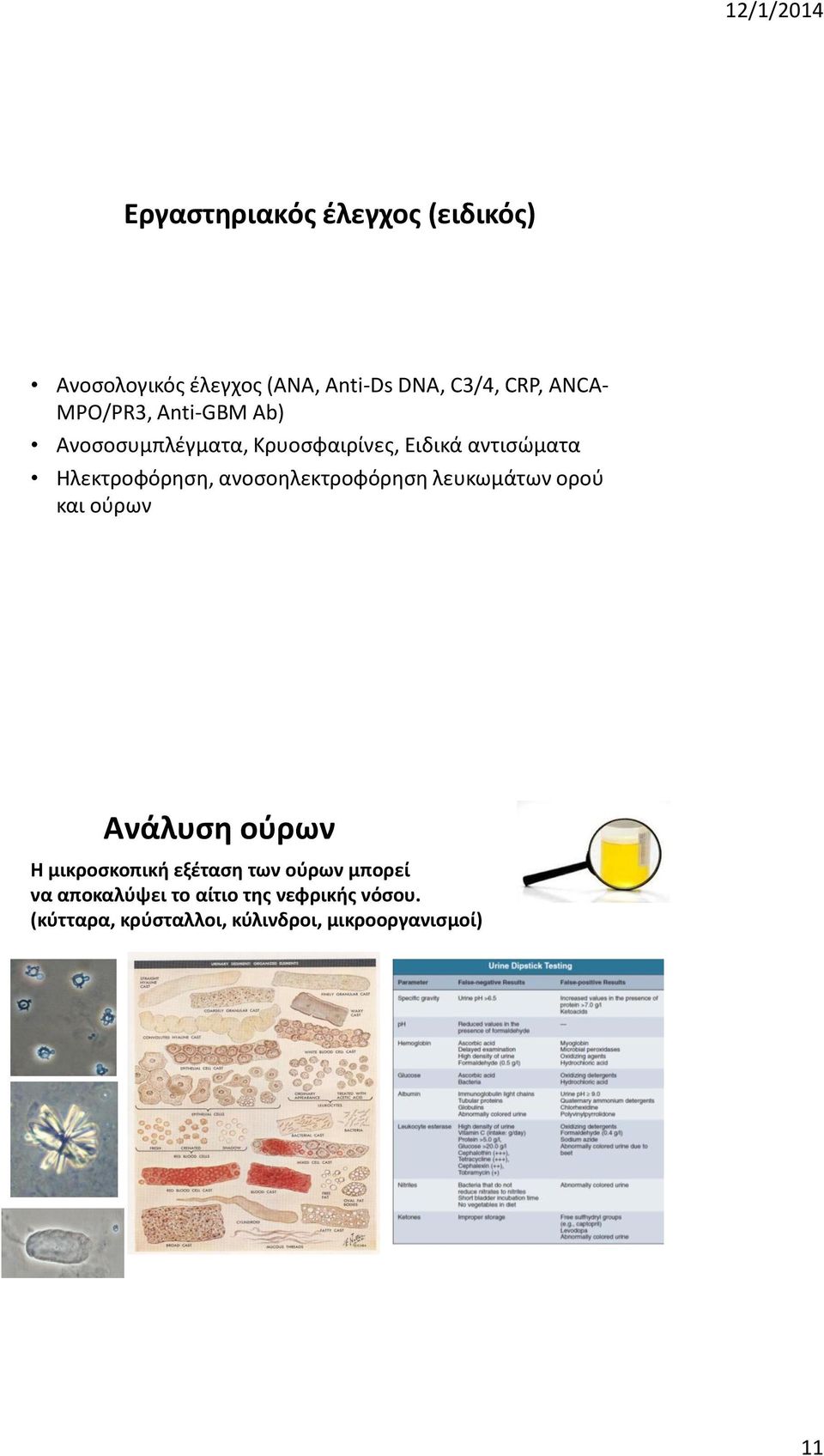 ανοσοηλεκτροφόρηση λευκωμάτων ορού και ούρων Ανάλυση ούρων Η μικροσκοπική εξέταση των ούρων