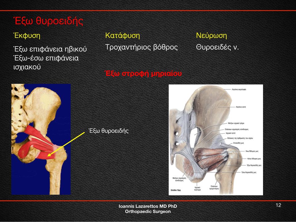 ισχιακού Τροχαντήριος βόθρος