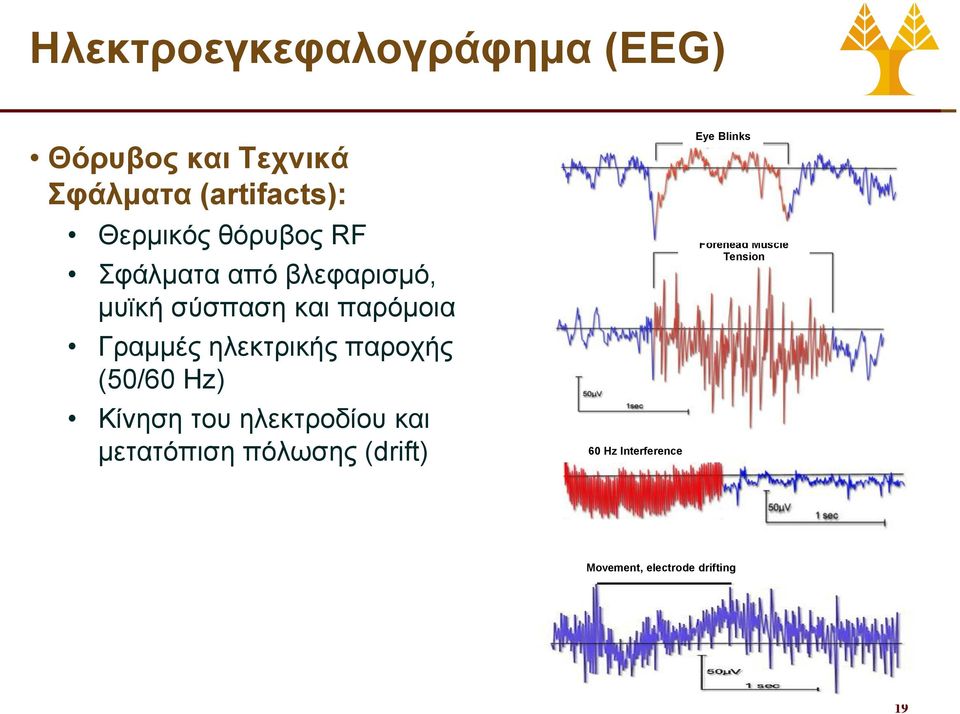 ηλεκτρικής παροχής (50/60 Hz) Κίνηση του ηλεκτροδίου και μετατόπιση πόλωσης