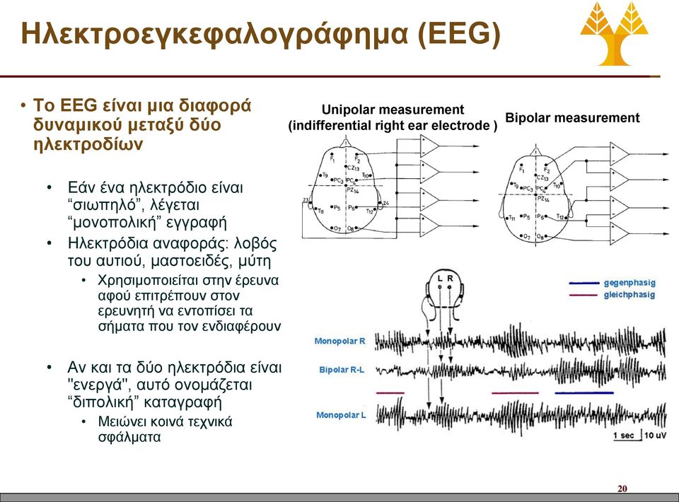 λοβός του αυτιού, μαστοειδές, μύτη Χρησιμοποιείται στην έρευνα αφού επιτρέπουν στον ερευνητή να εντοπίσει τα σήματα που τον