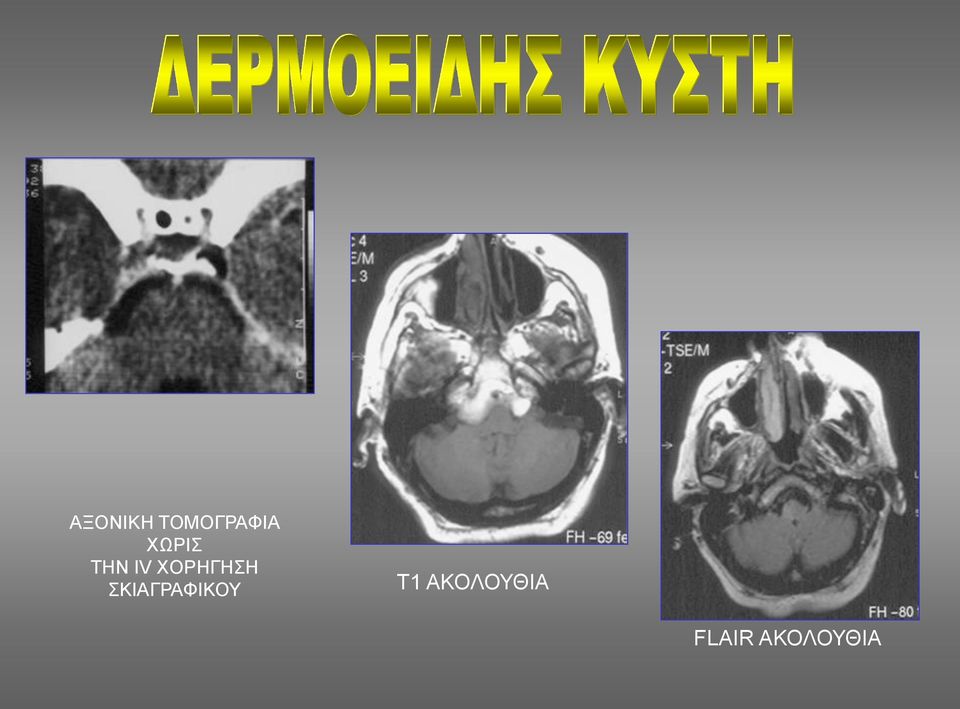 ΧΟΡΗΓΗΣΗ