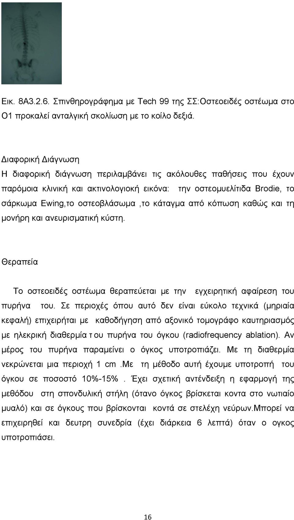 από κόπωση καθώς και τη µονήρη και ανευρισµατική κύστη. Θεραπεία Το οστεοειδές οστέωµα θεραπεύεται µε την εγχειρητική αφαίρεση του πυρήνα του.