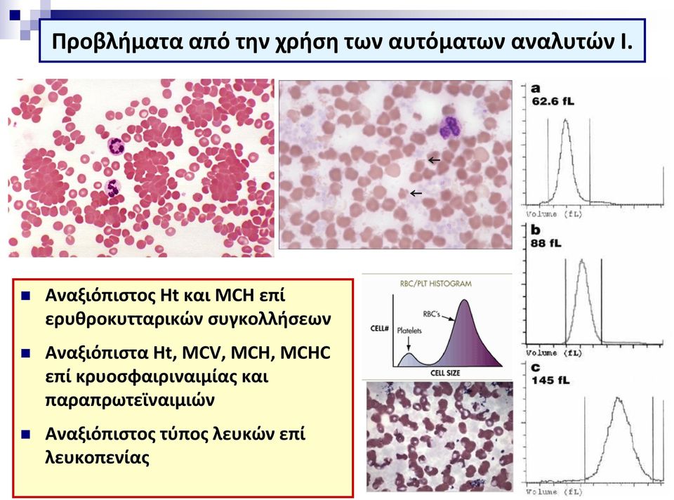 συγκολλήσεων Αναξιόπιστα Ht, MCV, MCH, MCHC επί