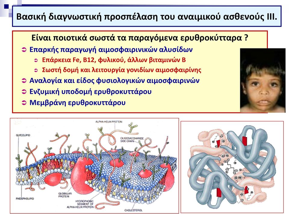 Επαρκής παραγωγή αιμοσφαιρινικών αλυσίδων Επάρκεια Fe, B12, φυλικού, άλλων βιταμινών Β
