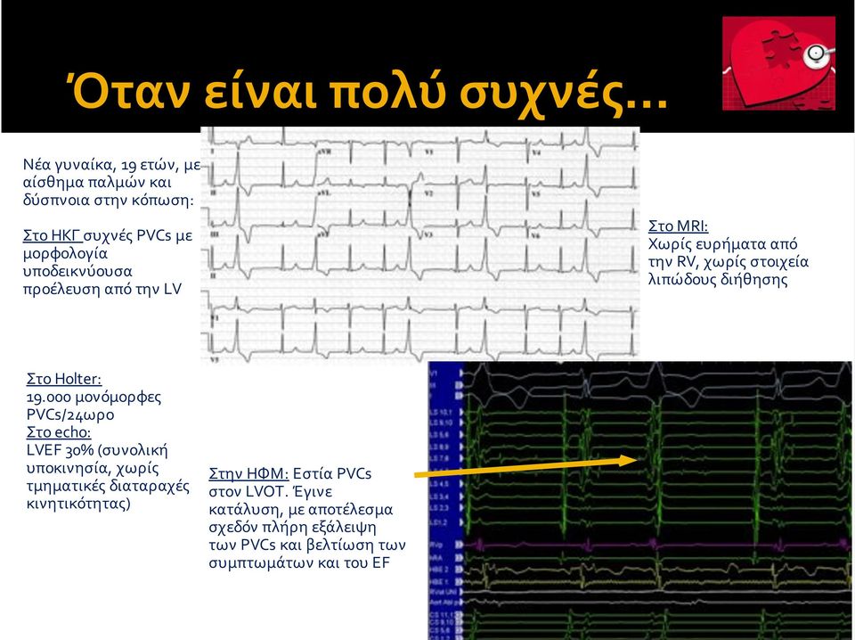 ΣτοHolter: 19.