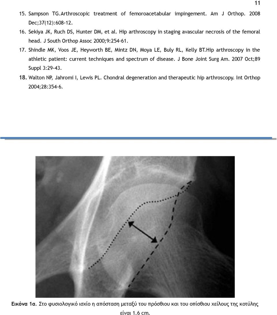 Shindle MK, Voos JE, Heyworth BE, Mintz DN, Moya LE, Buly RL, Kelly BT.Hip arthroscopy in the athletic patient: current techniques and spectrum of disease.